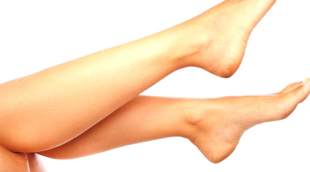 Can Lasers Remove Leg Veins?