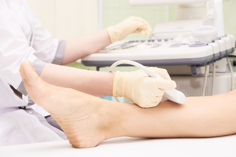 Why Do We Use Ultrasound To Assess Leg Veins?