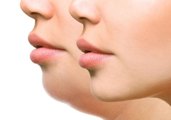 Part Of Face, Woman With The Double And Perfect Chin