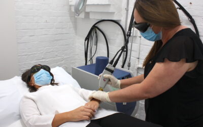 Laser Hair Removal: What You Need to Know Before Having Treatment