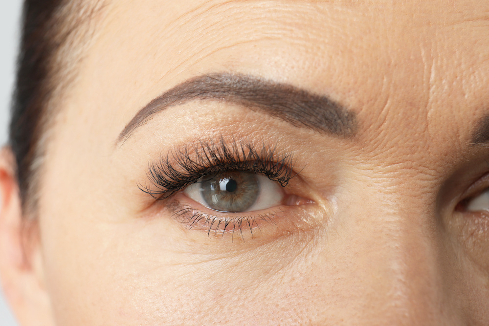 Brow Lift with Anti-wrinkle Injections