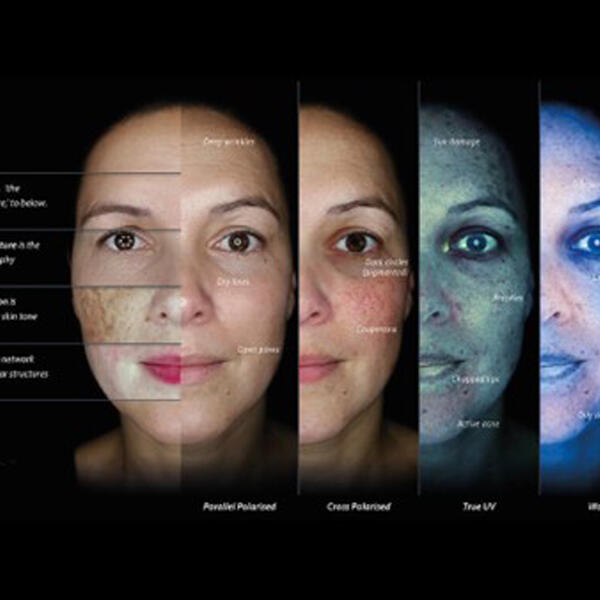 Observ Skin Analysis