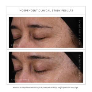 Superserum Clinicaldatacarousel13.jpg