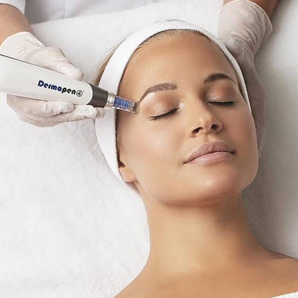 Skin needling treatment by Geelong Vein Skin & Laser
