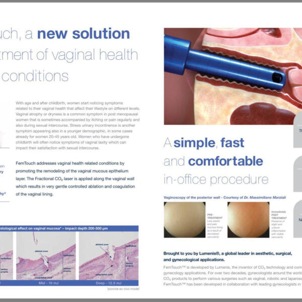 FemTouch vaginal laser treatment