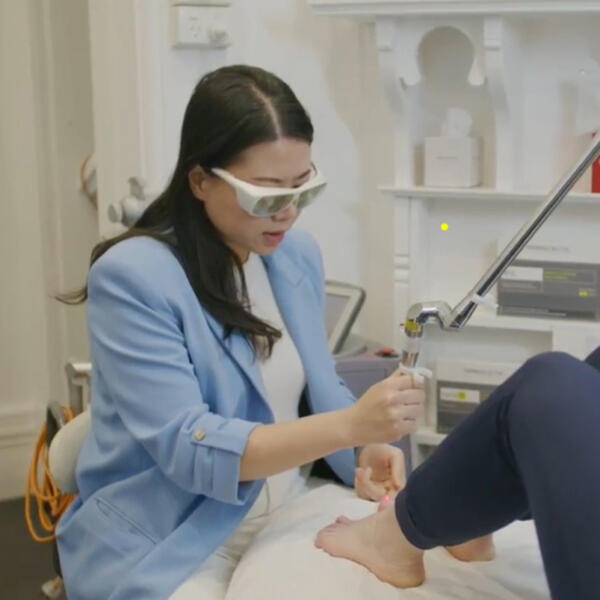 Wart removal laser treatment by Geelong Veins Skin & Laser