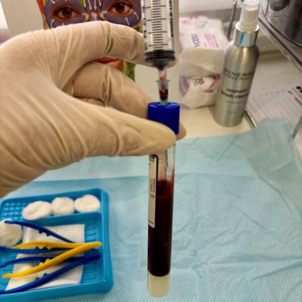 Prp3ofseries
