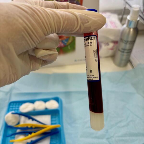 Prp4ofseries