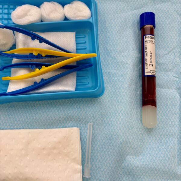 Prp5ofseries