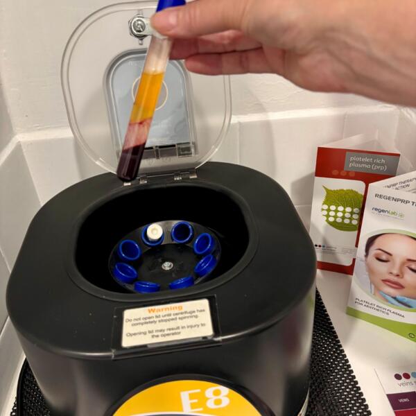 Prp7ofseries