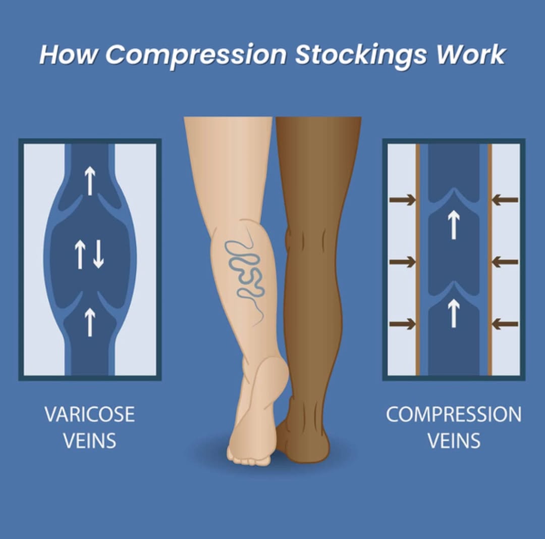 Medical Compression Stockings | Geelong Veins Skin & Laser