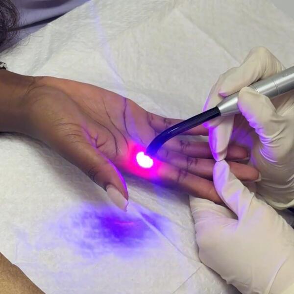 Photobiomodulating light treatment