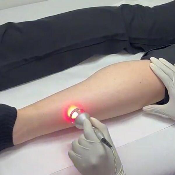 Photobiomodulating light treatment