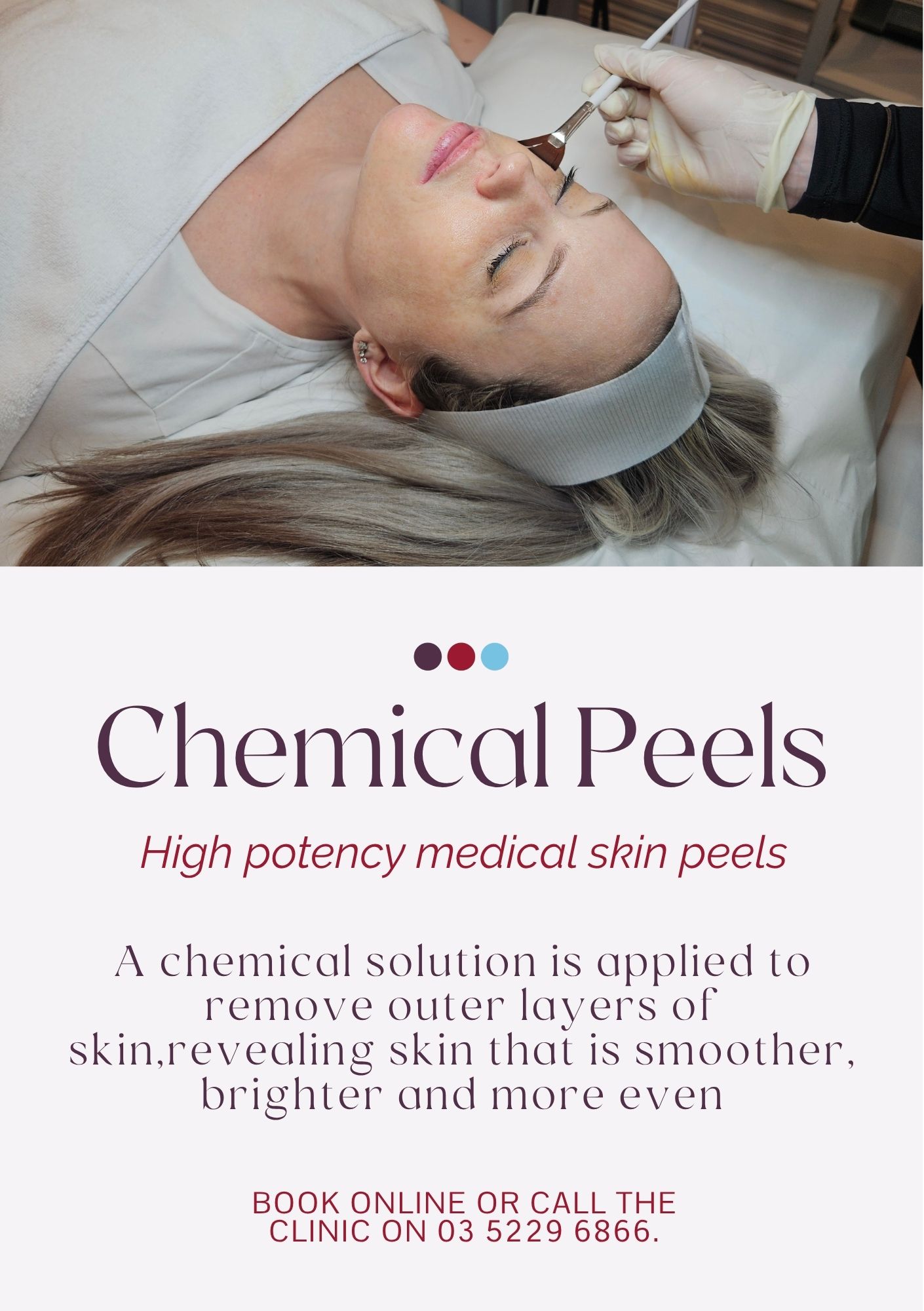 Website - Jul 26 - Chemical Peels