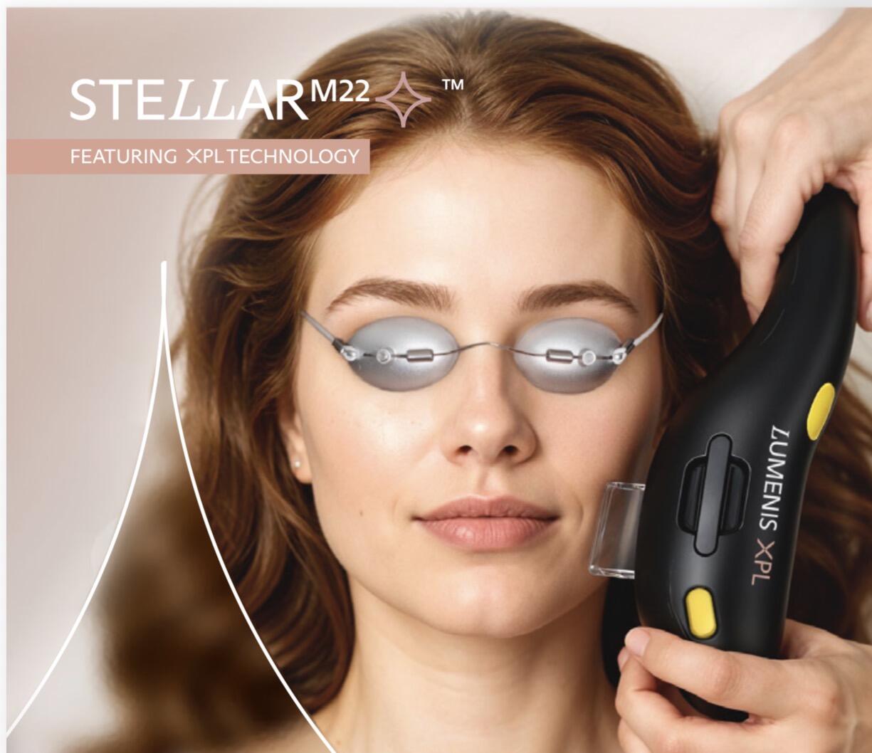 Practitioner treating a woman's cheek with the Lumenis XPL handpiece while she wears protective eye shields, Stellar M22 XPL technology